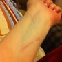 Yesterday I got mauled by a Maltese at work. Now it kinda stings. WARNING: GRAPHIC. 